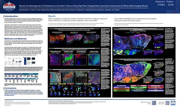 Thumbnail of Human Glioblastoma Poster