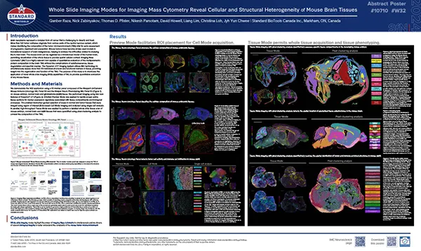 Thumbnail of Mouse Neuro Oncology Poster