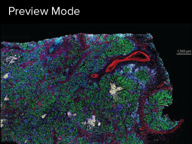 Preview Mode | Number of markers: 42, Acquisition time: 20 minutes, Sample: colon cancer (25 mm x 15 mm)