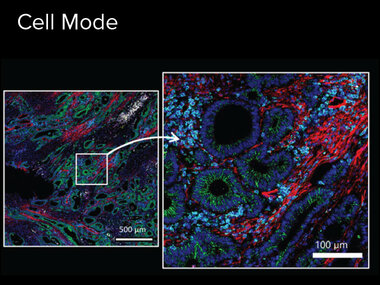 Cell Mode | Number of markers: 42, Acquisition time: 2 hours, Sample: colon cancer (2 mm x 2 mm), Resolution: 1 μm