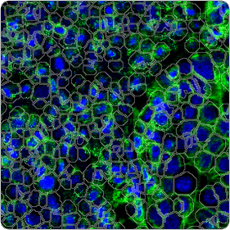 Standard BioTools Cell Segmentation